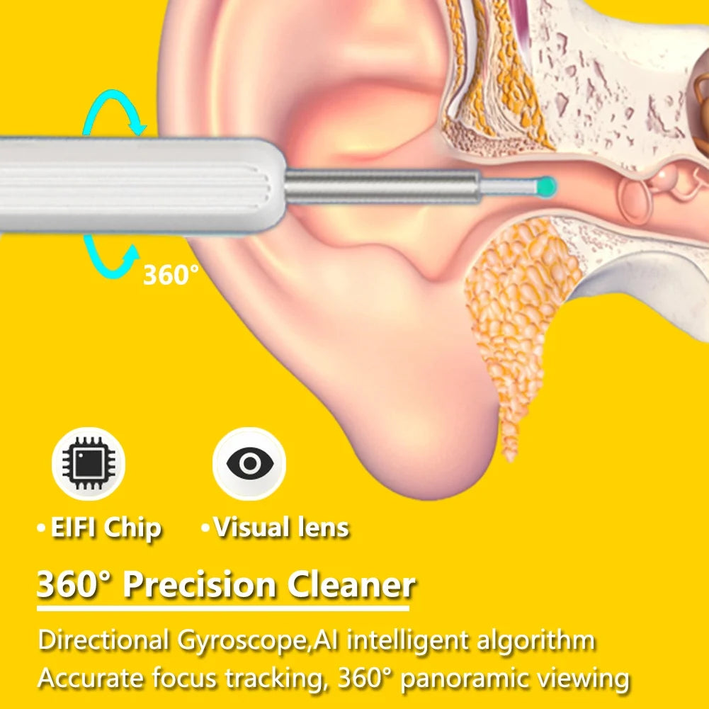 Ear Cleaner with 10 Pieces Earpicks, Ear Wax Removal Tool, 1296P HD Smart Visual Earwax Remove Kits 4 Ear Tips Replacement and 6 LED Lights (White)